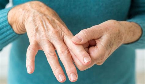 osteoartrit romatoid artrit farklari